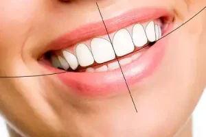 اصلاح طرح لبخند در رشت | زیبایی دندان با خدمات تخصصی دکتر دشت بزرگی